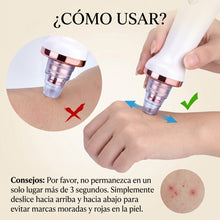 Cargar imagen en el visor de la galería, Succionador de poros
